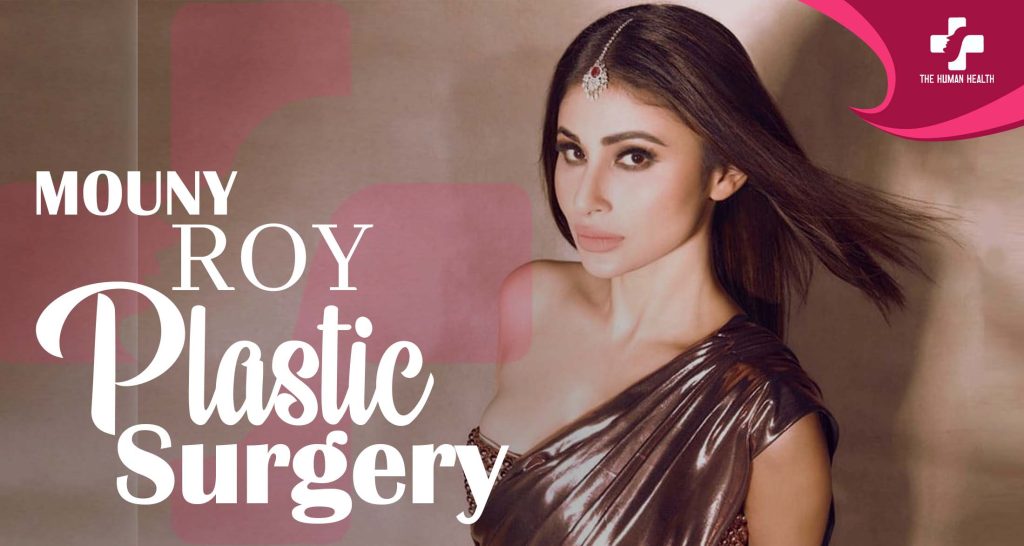 Mouni Roy Plastic Surgery: Stunning New Secrets