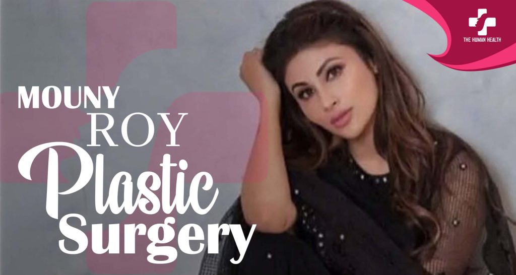 Mouni Roy Plastic Surgery: Stunning New Secrets