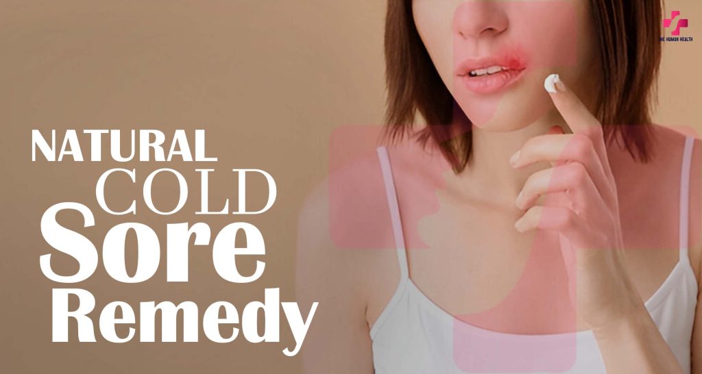 Natural Cold Sore Remedy: Amazing Tips You Need!
