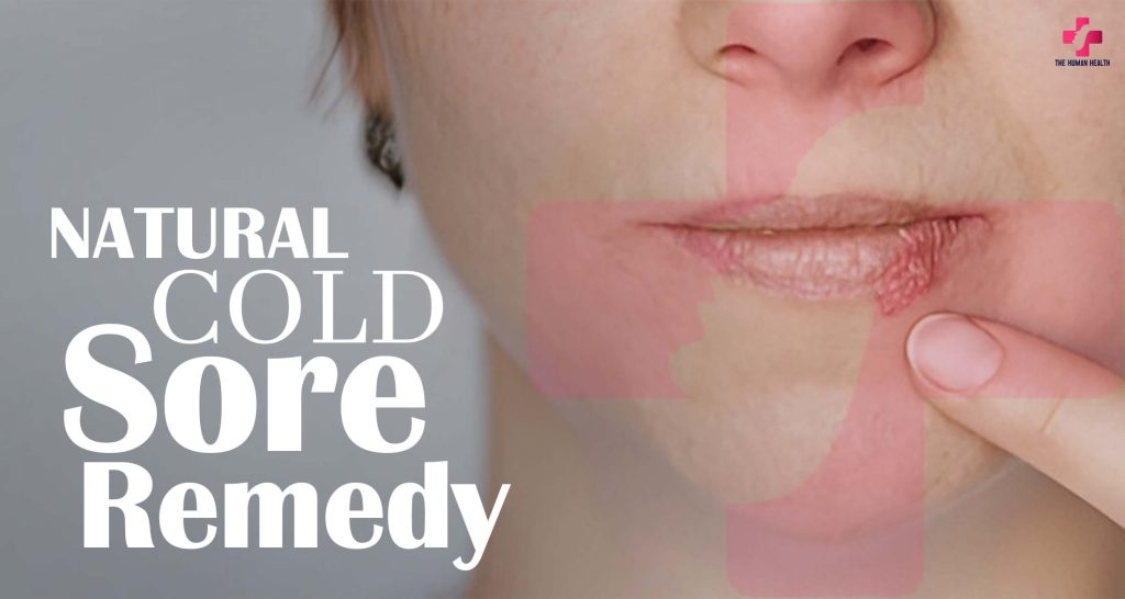 Natural Cold Sore Remedy: Amazing Tips You Need!
