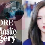 Lisa Before Plastic Surgery: Stunning Then & Now