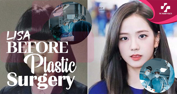 Lisa Before Plastic Surgery: Stunning Then & Now