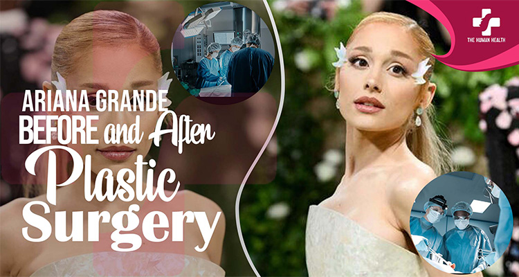 Ariana Grande Before and After