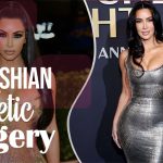 Kim Kardashian Before Surgery