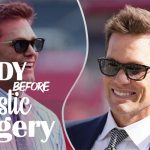 Tom Brady Before Plastic Surgery