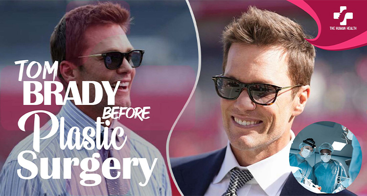 Tom Brady Before Plastic Surgery
