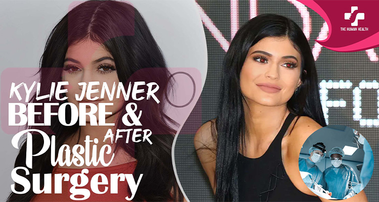 Kylie Jenner Plastic Surgery