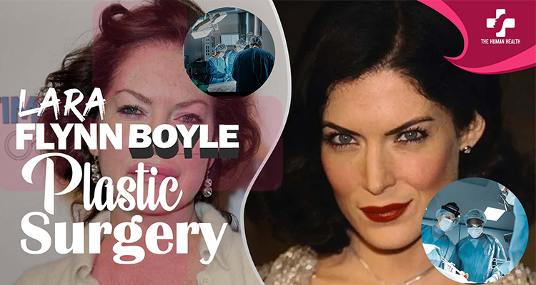 Lara Flynn Boyle Plastic Surgery