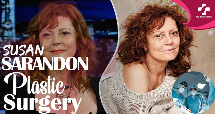 Susan Sarandon Plastic Surgery