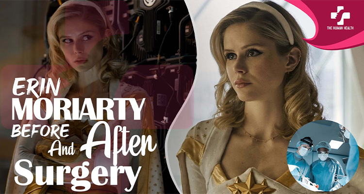 Erin Moriarty Before And After Surgery