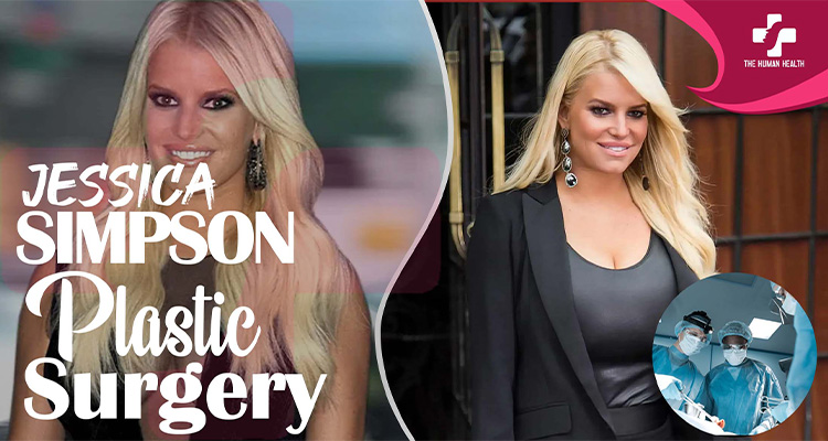 Jessica Simpson Plastic Surgery