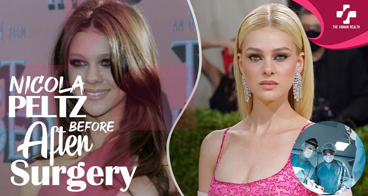 Nicola Peltz Before And After Surgery: Surprising, Remarkable, Genuine Secrets