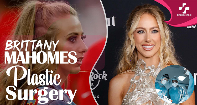 Brittany Mahomes Plastic Surgery
