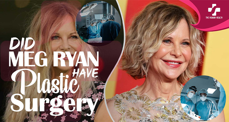 Did Meg Ryan Have Plastic Surgery