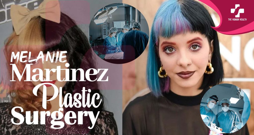 Melanie Martinez Plastic Surgery Exposed – Shocking Secrets