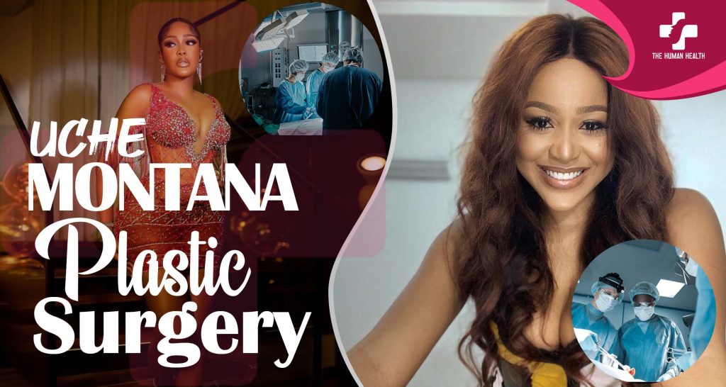 Uche Montana Surgery Secrets You Must Know