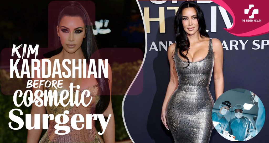 Kim Kardashian Before Surgery Exclusive Truth About?
