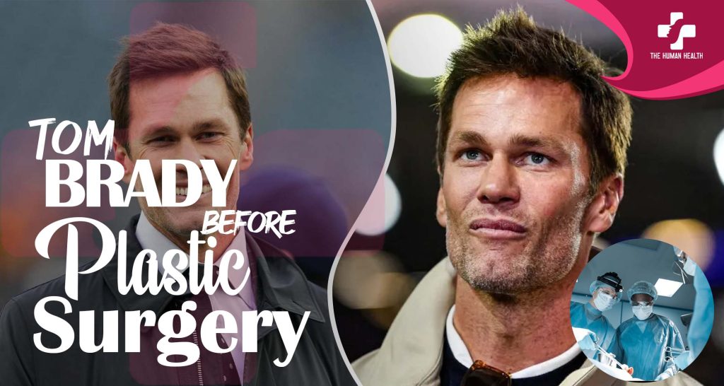 Tom Brady Before Plastic Surgery Revealed Now