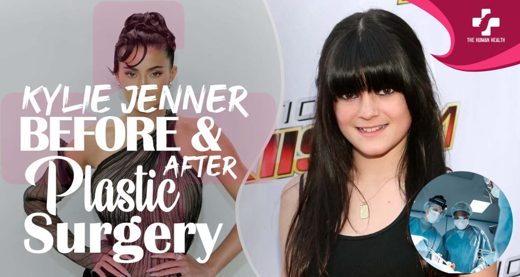 Kylie Jenner Plastic Surgery The Truth About.!