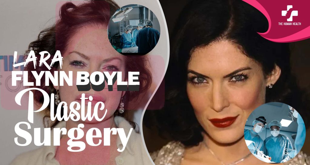 Lara Flynn Boyle Plastic Surgery Secrets Exposed