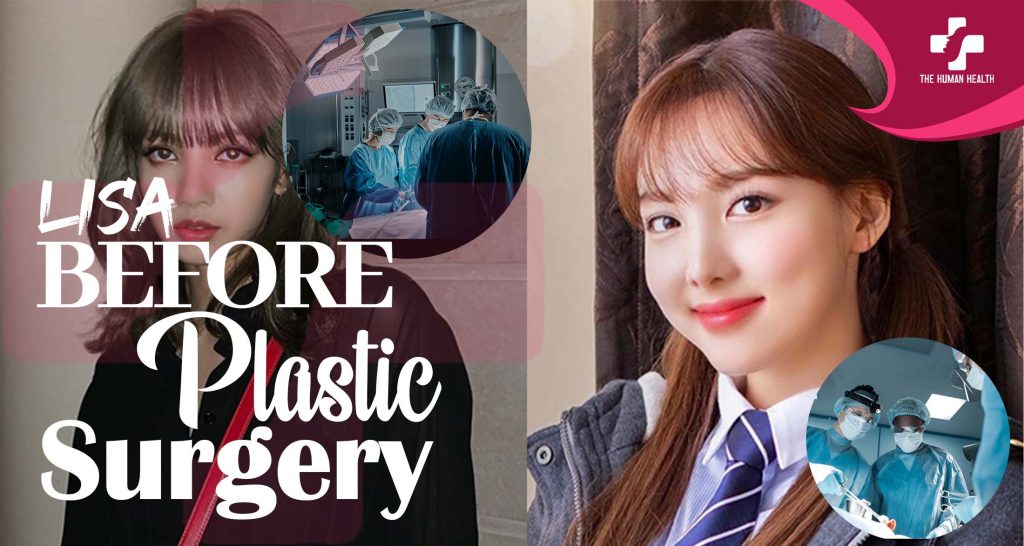 Lisa Before Plastic Surgery: Stunning Then & Now