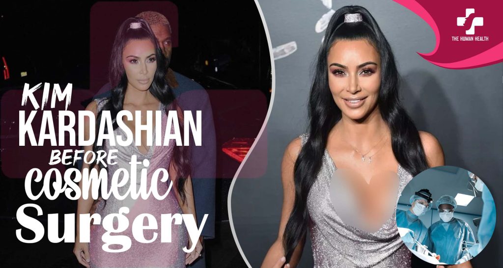 Kim Kardashian Before Surgery Exclusive Truth About?