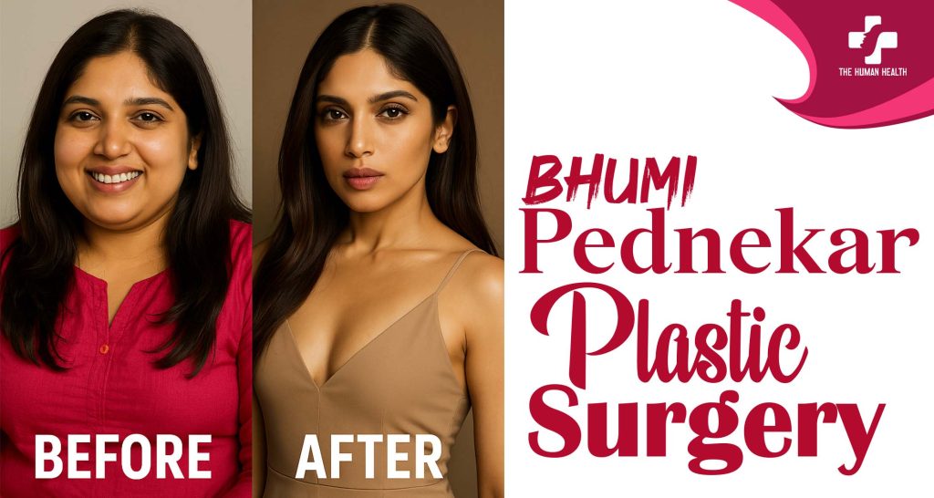 Bhumi Pednekar Plastic Surgery – What Happened?