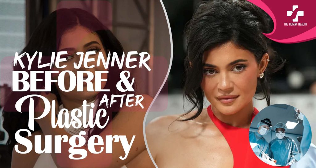 Kylie Jenner Plastic Surgery The Truth About.!