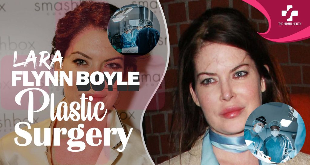 Lara Flynn Boyle Plastic Surgery Secrets Exposed