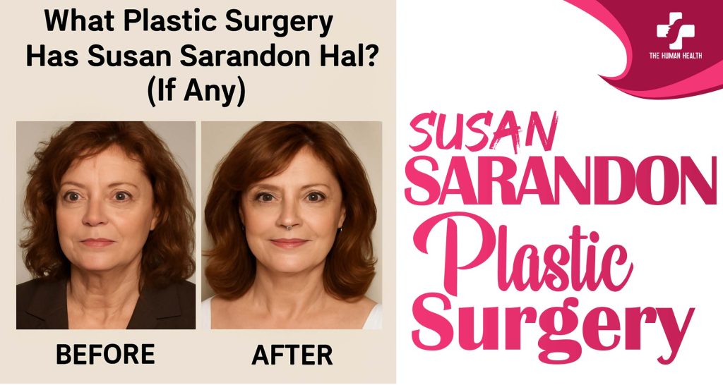 Susan Sarandon Plastic Surgery: Eye-Opening New Look