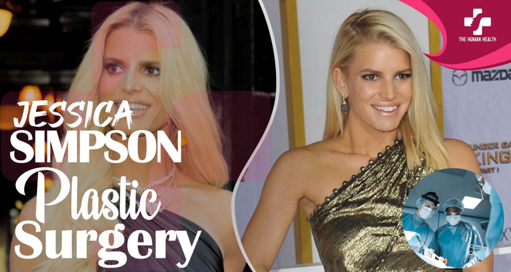 Jessica Simpson Plastic Surgery: What You Need To Know