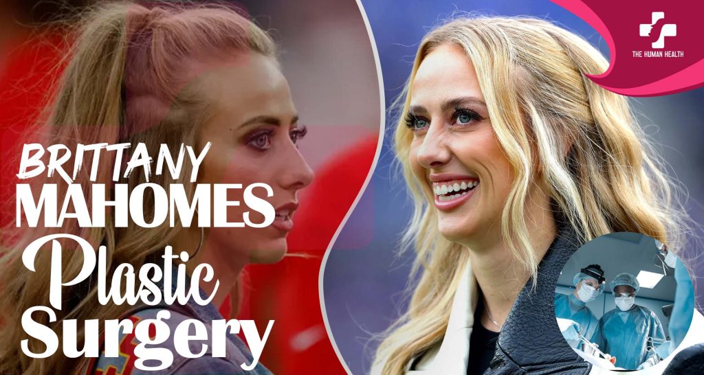 Brittany Mahomes Plastic Surgery: Eye-Opening New Look