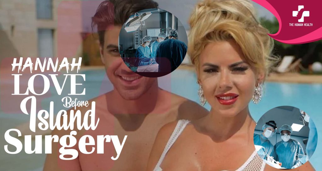 Hannah Love Island Before Surgery Exposed