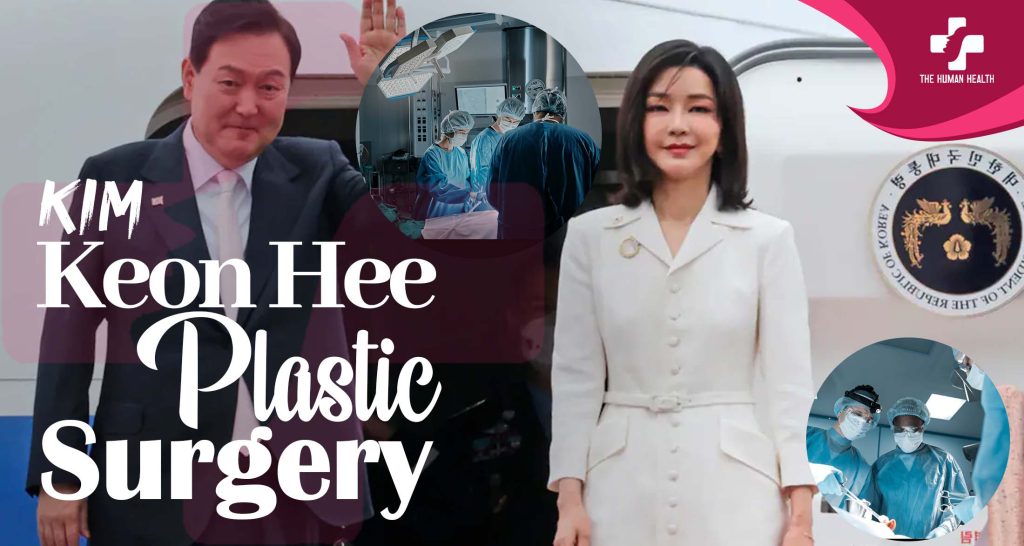 Kim Keon Hee Plastic Surgery Obsession: What Happened?
