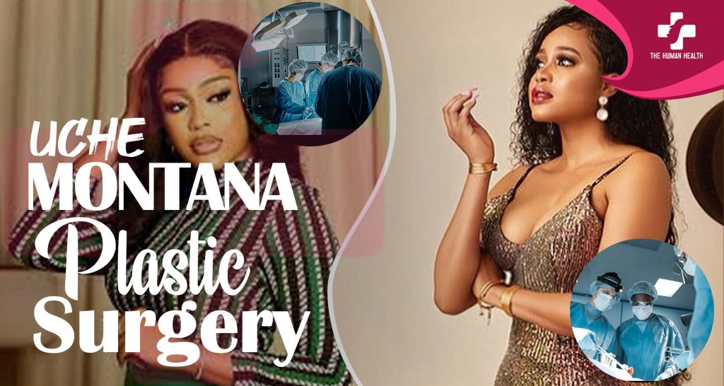 Uche Montana Surgery Secrets You Must Know