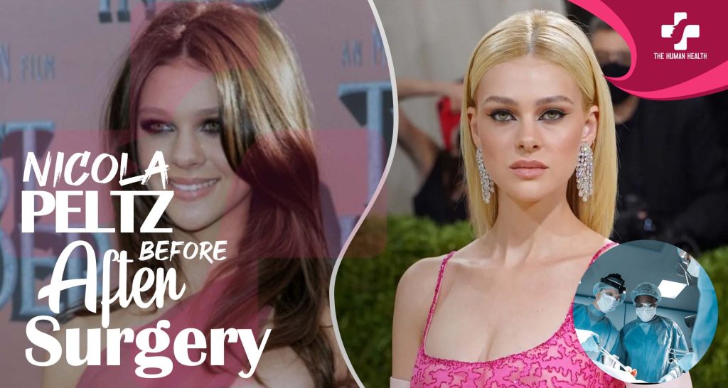 Nicola Peltz Before And After Surgery: Surprising, Remarkable, Genuine Secrets