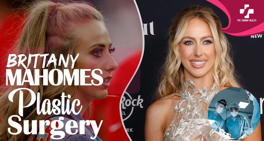 Brittany Mahomes Plastic Surgery: Eye-Opening New Look