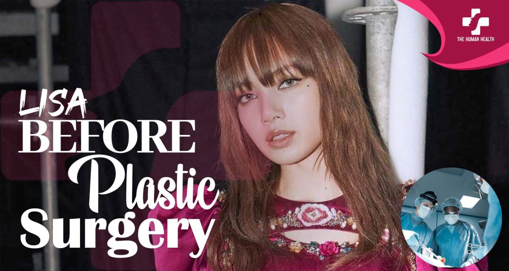 Lisa Before Plastic Surgery: Stunning Then & Now