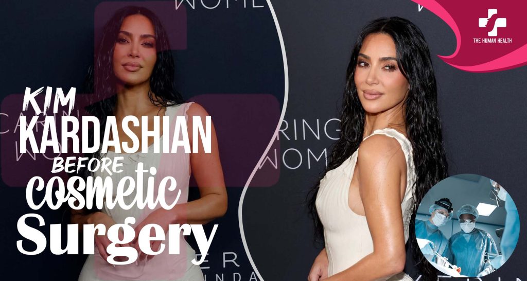 Kim Kardashian Before Surgery Exclusive Truth About?