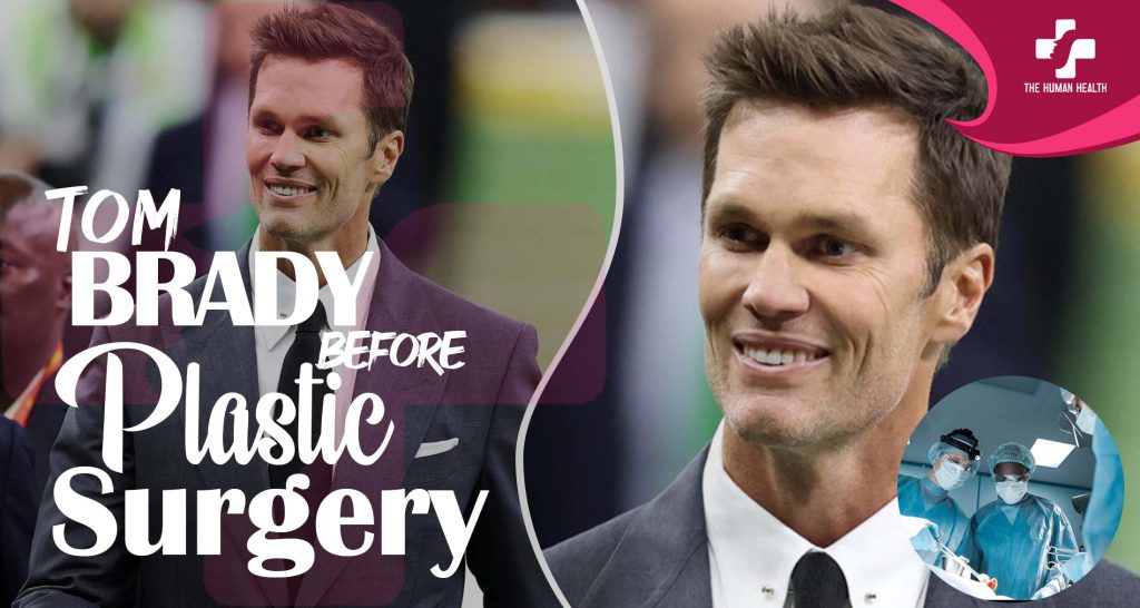 Tom Brady Before Plastic Surgery Revealed Now