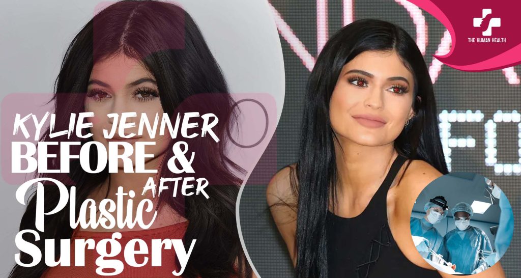Kylie Jenner Plastic Surgery The Truth About.!