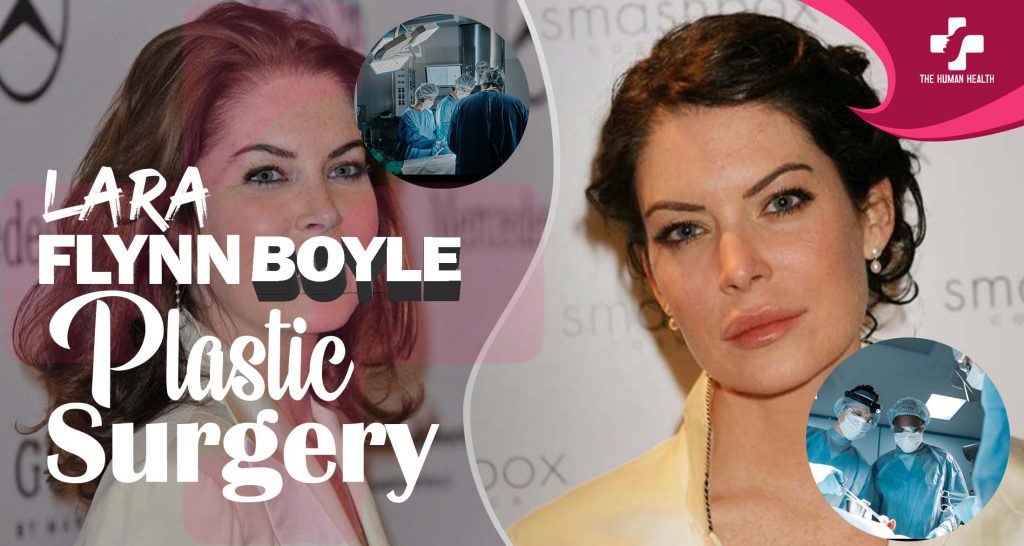 Lara Flynn Boyle Plastic Surgery Secrets Exposed