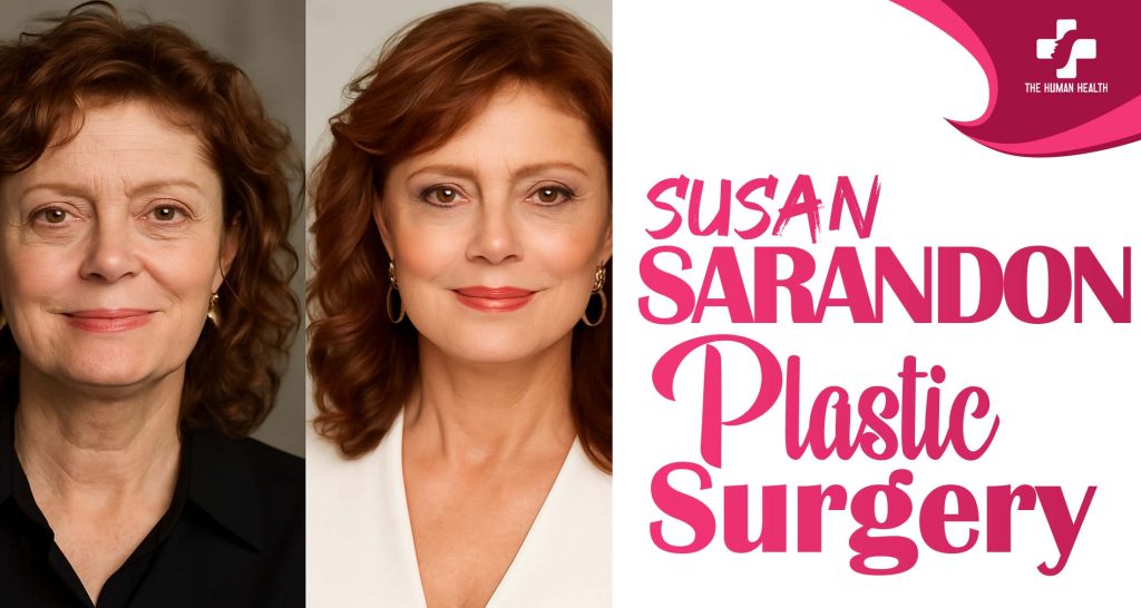 Susan Sarandon Plastic Surgery: Eye-Opening New Look
