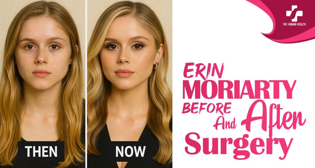 Erin Moriarty Before And After Surgery: Jaw-Dropping Secrets
