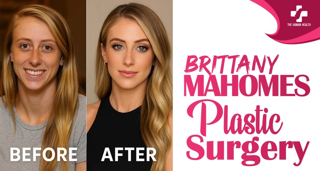Brittany Mahomes Plastic Surgery: Eye-Opening New Look