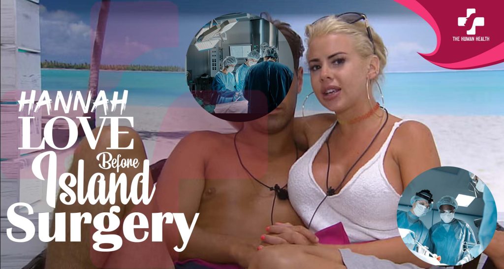 Hannah Love Island Before Surgery Exposed