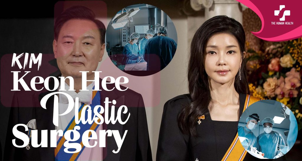 Kim Keon Hee Plastic Surgery Obsession: What Happened?
