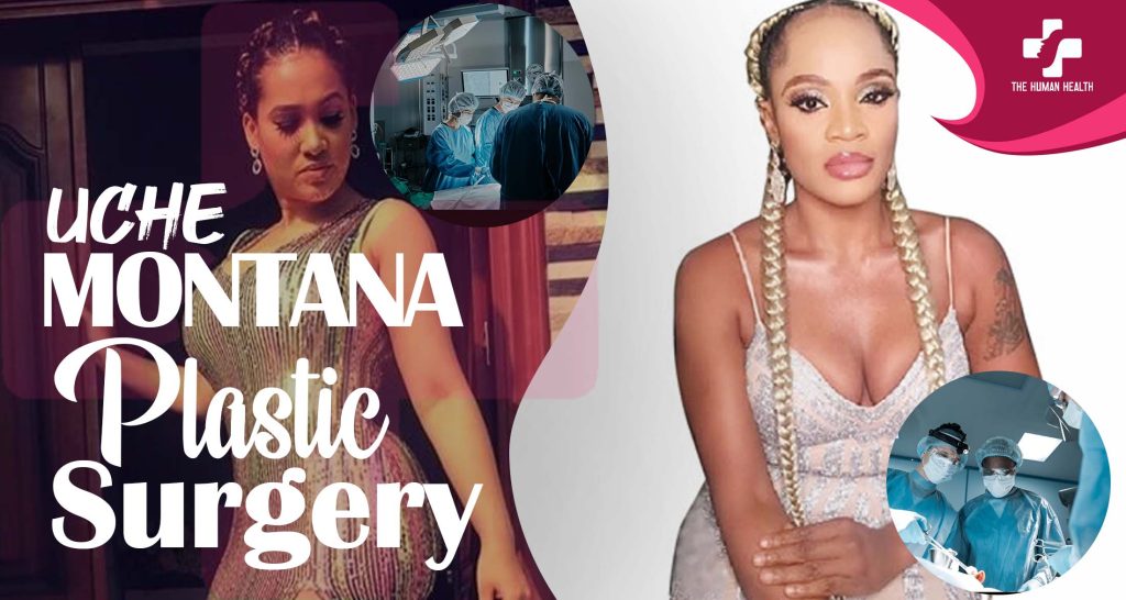 Uche Montana Surgery Secrets You Must Know
