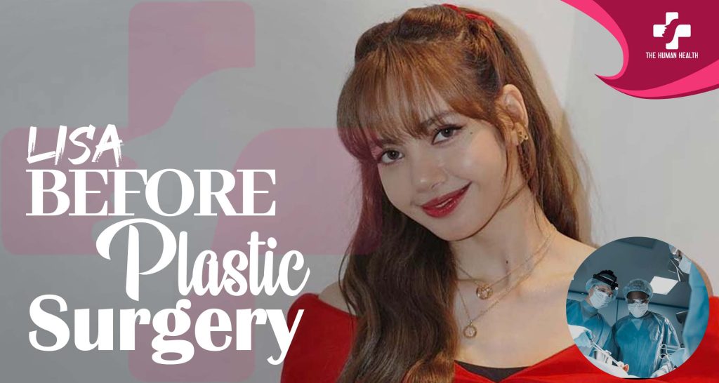 Lisa Before Plastic Surgery: Stunning Then & Now