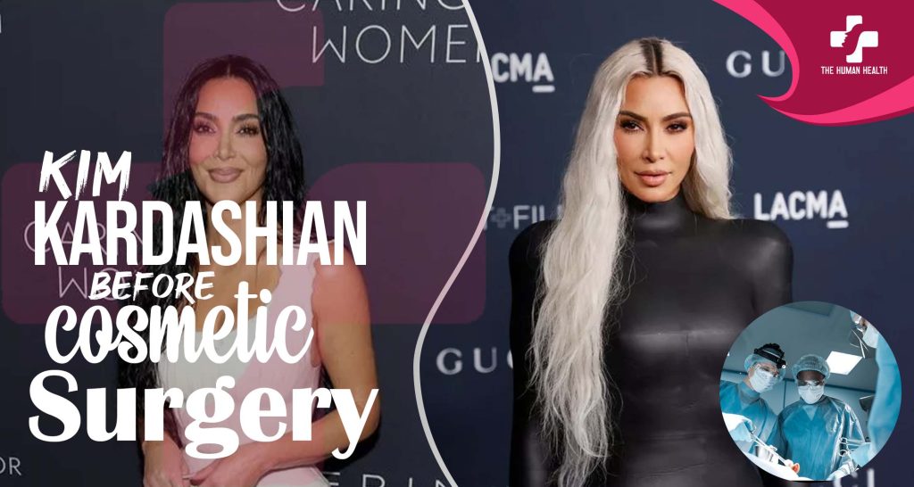 Kim Kardashian Before Surgery Exclusive Truth About?
